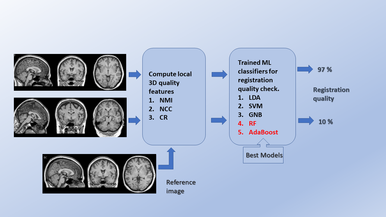 Fully automated quality control of rigid and affine registrations of T1w and T2w MRI in Big Data using Machine Learning